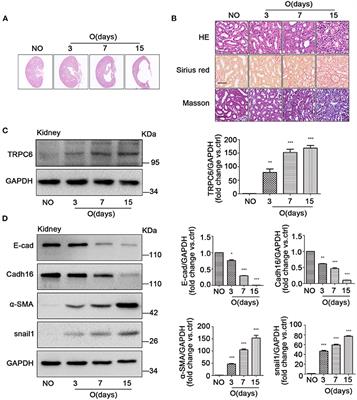 Transient Receptor Potential Channel 6 Knockout Ameliorates Kidney Fibrosis by Inhibition of Epithelial–Mesenchymal Transition